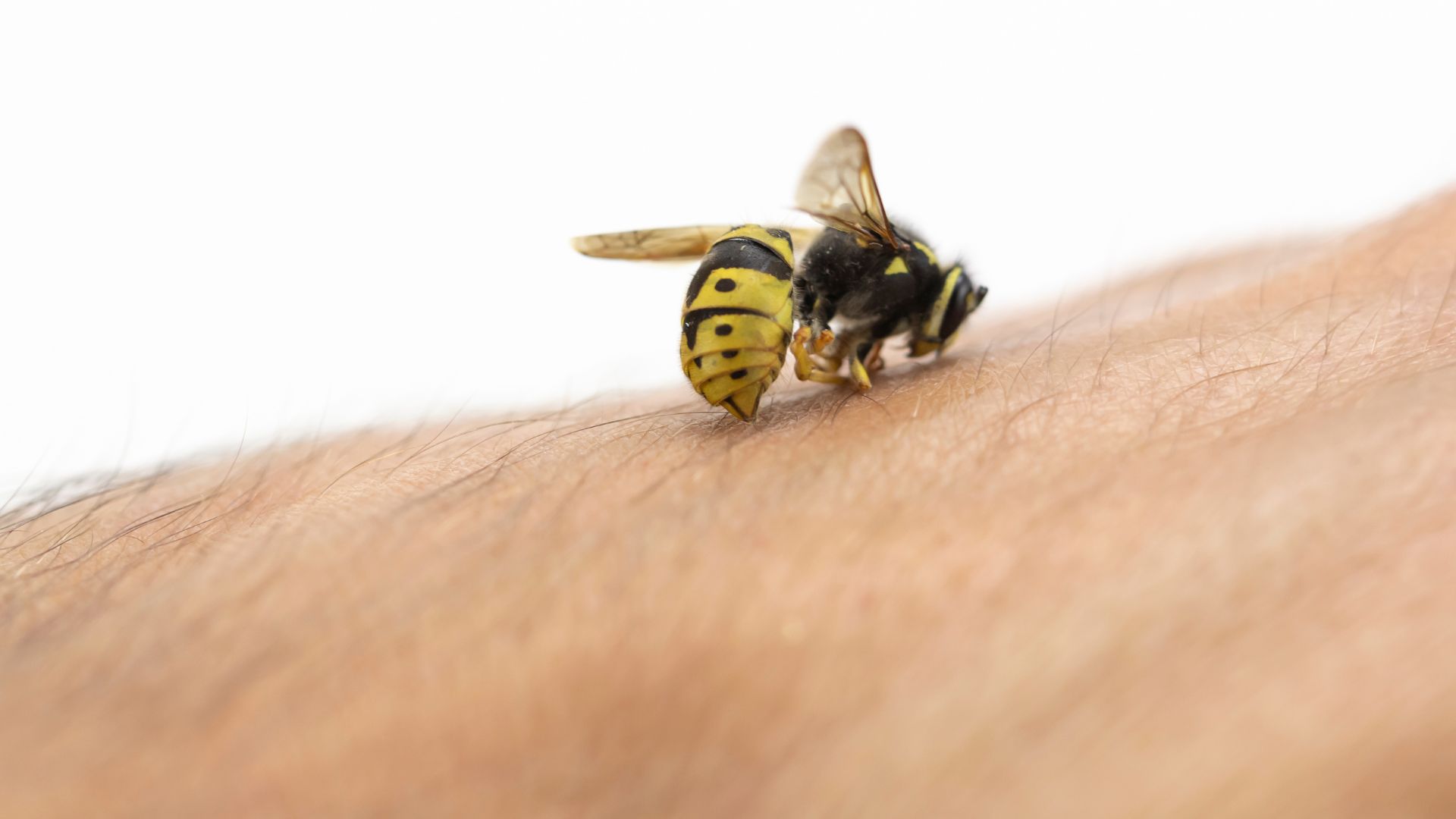 Have You Been Stung? What to Do When You’re Stung by an Insect or Bee
